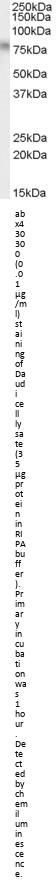 Transcription Factor E2-Alpha (TCF3) Antibody