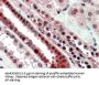 Transcription Factor E2-Alpha (TCF3) Antibody
