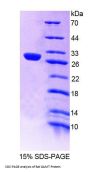 Rat Guanidinoacetate-N-Methyltransferase (GAMT) Protein