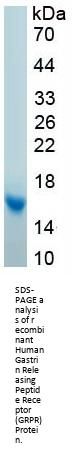 Human Gastrin Releasing Peptide Receptor (GRPR) Protein