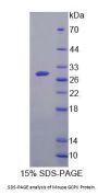 Mouse Glutamate Carboxypeptidase II (GCPII) Protein