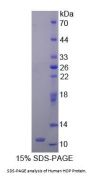 Human Homeodomain Only Protein (HOP) Protein