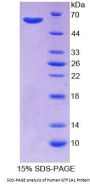 Human General Transcription Factor IIA, Polypeptide 1 (GTF2A1) Protein