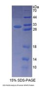 Human Nephronophthisis 2, Infantile (NPHP2) Protein