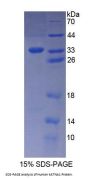Human Katanin P60 Subunit A 1 (KATNA1) Protein