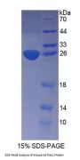 Mouse Katanin P60 Subunit A 1 (KATNA1) Protein
