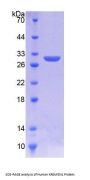 Human Kringle Containing Transmembrane Protein 1 (KREMEN1) Protein