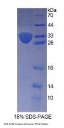 Human Kinectin 1 (KTN1) Protein