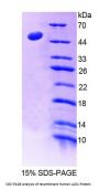 Human Ladinin 1 (LAD1) Protein