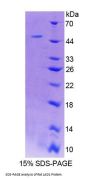Rat Ladinin 1 (LAD1) Protein