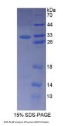 Human Leucine Zipper, Down Regulated In Cancer 1 (LDOC1) Protein
