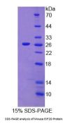Mouse Eukaryotic translation initiation factor 2D (EIF2D) Protein