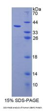 Human Ubiquitin Associated Protein 1 (UBAP1) Protein