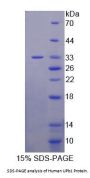 Human Ureidopropionase Beta (UPb1) Protein