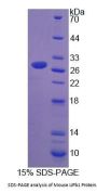 Mouse Ureidopropionase Beta (UPb1) Protein
