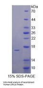 Human Uroplakin 1A (UPK1A) Protein