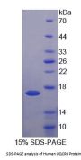 Human Ubiquinol Cytochrome C Reductase Binding Protein (UQCRB) Protein