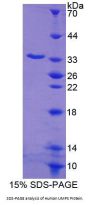 Human Uridine Monophosphate Synthetase (UMPS) Protein