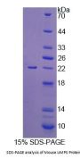 Mouse Uridine Monophosphate Synthetase (UMPS) Protein