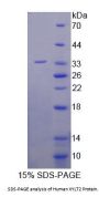 Human Xylosyltransferase II (XYLT2) Protein