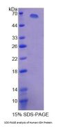 Human Xanthine Dehydrogenase/Oxidase (XDH) Protein