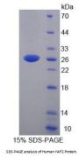 Human YY1 Associated Factor 2 (YAF2) Protein