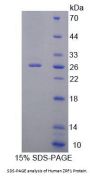 Human Zuotin Related Factor 1 (ZRF1) Protein