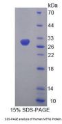 Human Mitofusin 1 (MFN1) Protein