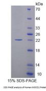 Human Molybdenum Cofactor Synthesis 1 (MOCS1) Protein