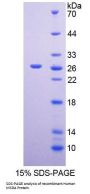 Human Methionine Sulfoxide Reductase A (MSRA) Protein