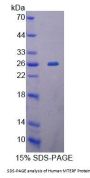 Human Mitochondrial Transcription Termination Factor (MTERF) Protein