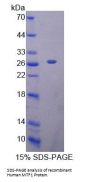 Human Metal Regulatory Transcription Factor 1 (MTF1) Protein