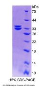 Human Mitochondrial Tumor Suppressor 1 (MTUS1) Protein