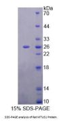 Rat Mitochondrial Tumor Suppressor 1 (MTUS1) Protein