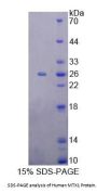 Human Metaxin 1 (MTX1) Protein