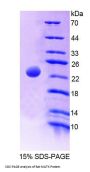 Rat Megakaryocyte Associated Tyrosine Kinase (MATK) Protein