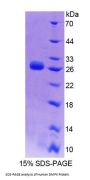 Human Dystrophia Myotonica Protein Kinase (DMPK) Protein