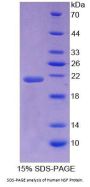 Human N-Ethylmaleimide Sensitive Factor (NSF) Protein