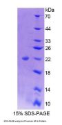 Human Nuclear Factor I/A (NFIA) Protein