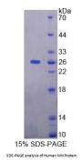 Human Ninein (NIN) Protein