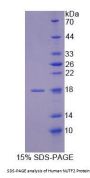 Human Nuclear Transport Factor 2 (NUTF2) Protein