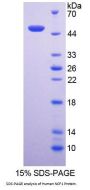 Human Neutrophil Cytosolic Factor 1 (NCF1) Protein