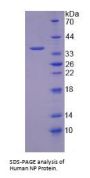 Human Nucleoside Phosphorylase (NP) Protein