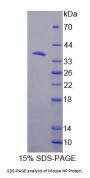 Mouse Nucleoside Phosphorylase (NP) Protein