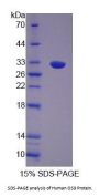 Human Osteosarcoma Amplified 9 (OS9) Protein