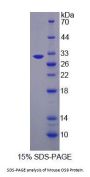 Mouse Osteosarcoma Amplified 9 (OS9) Protein