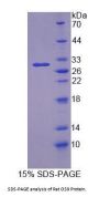 Rat Osteosarcoma Amplified 9 (OS9) Protein