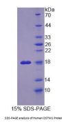 Human Osteopetrosis Associated Transmembrane Protein 1 (OSTM1) Protein