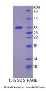 Human Protein-Arginine Deiminase Type 1 (PADI1) Protein
