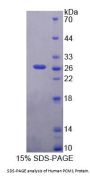 Human Pericentriolar Material 1 (PCM1) Protein